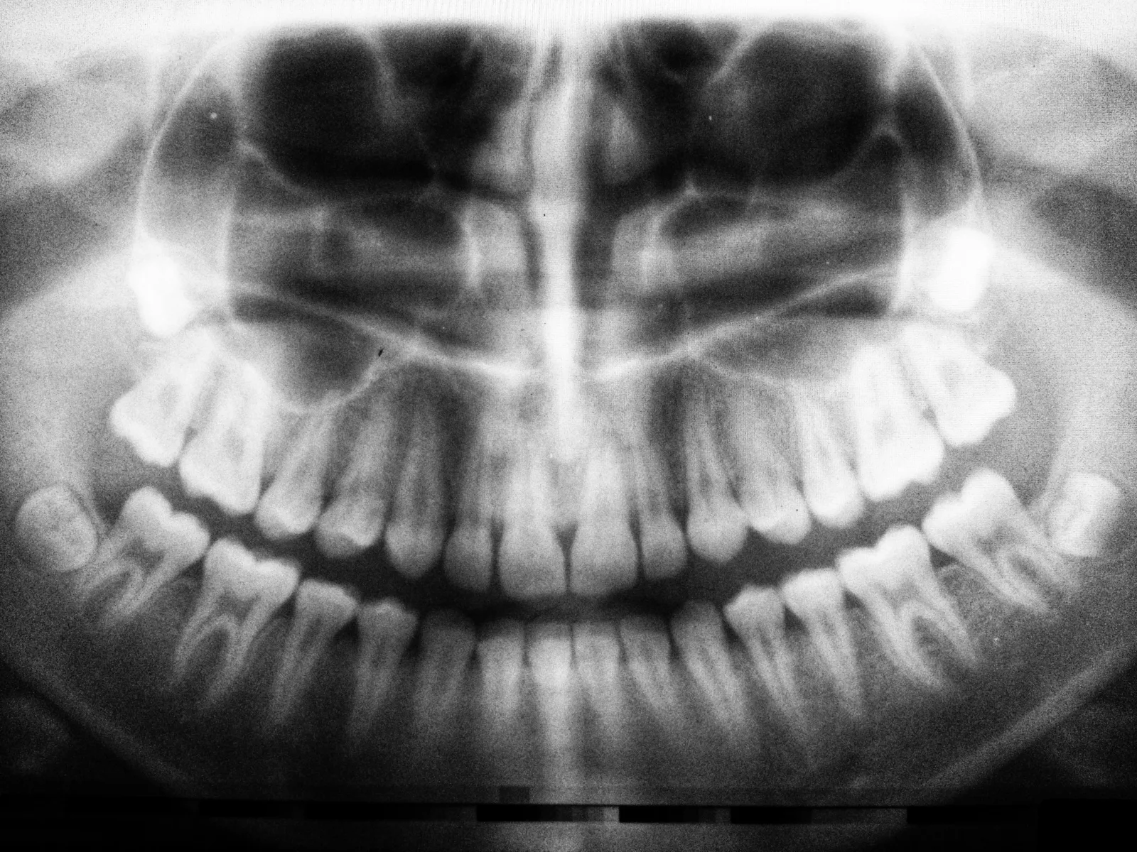 Illustrazione clinica: chirurgia odontostomatologica