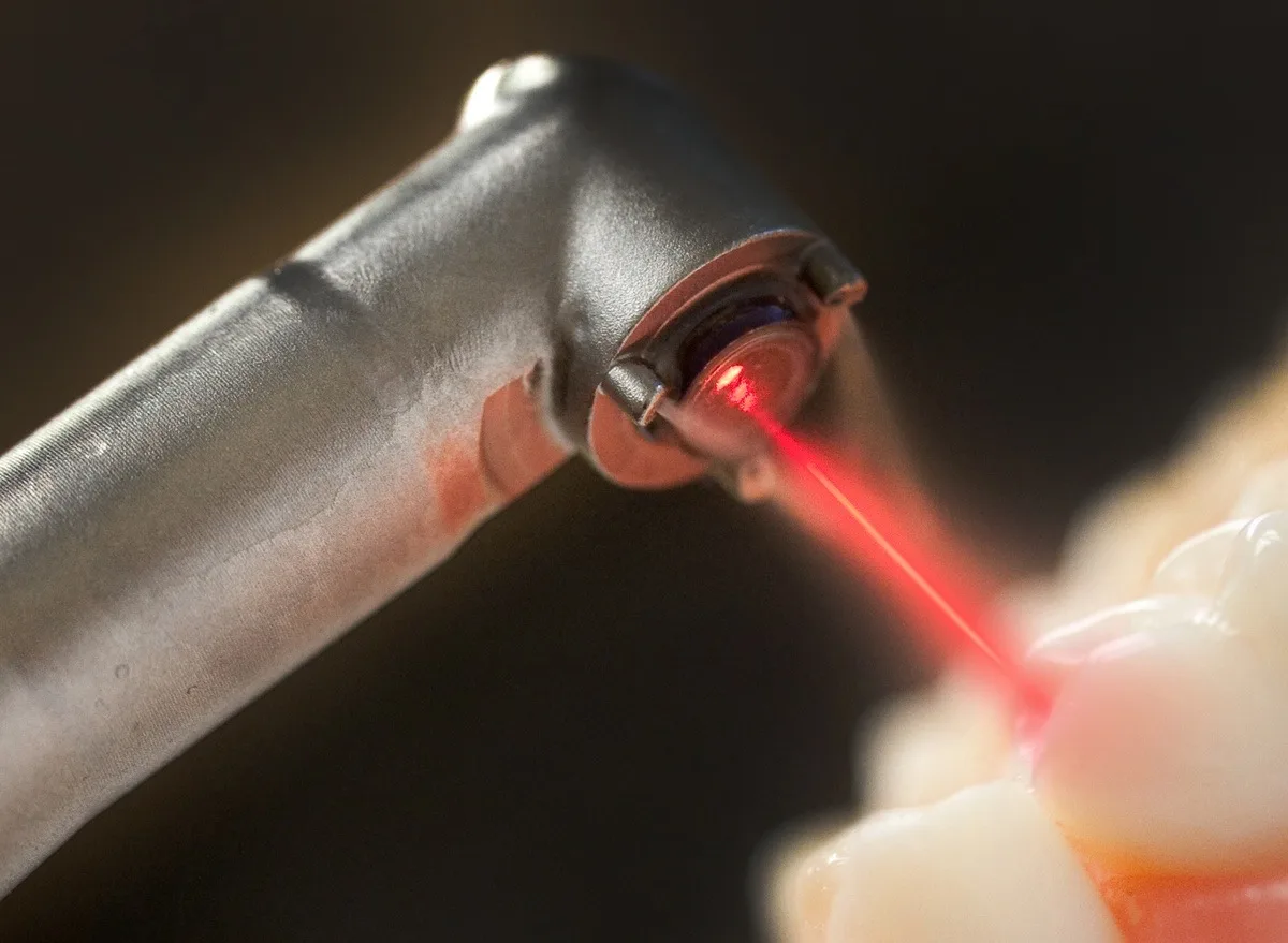 Illustrazione clinica: laser terapia